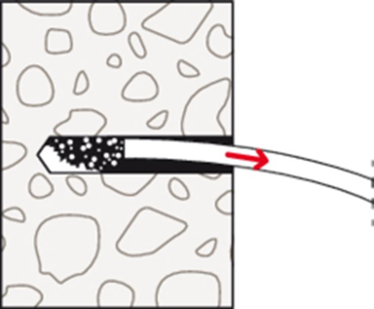 hulsanker elvz fischer hulsanker elvz fischer